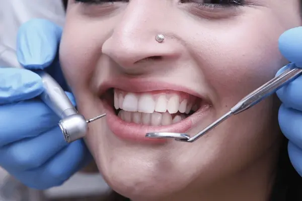 smile design in mississauga, on
