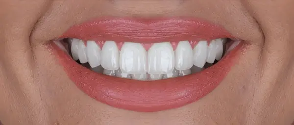 smile design near you